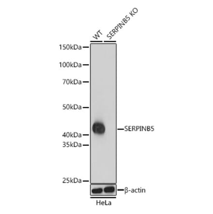 Western Blot - Anti-MASPIN Antibody (A13355) - Antibodies.com