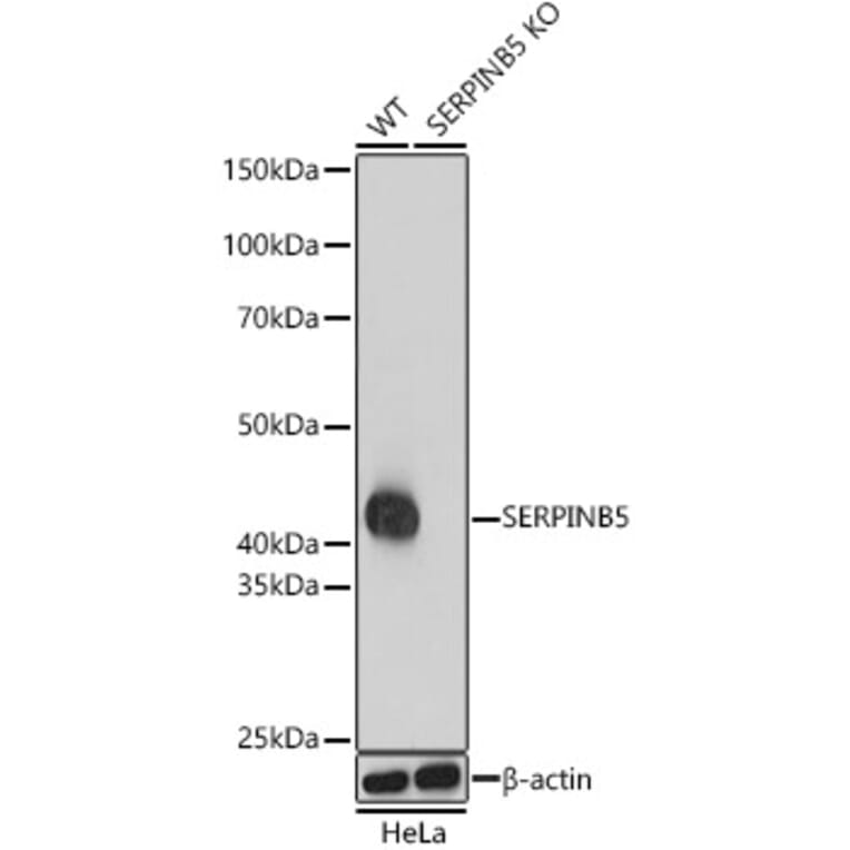 Western Blot - Anti-MASPIN Antibody (A13355) - Antibodies.com