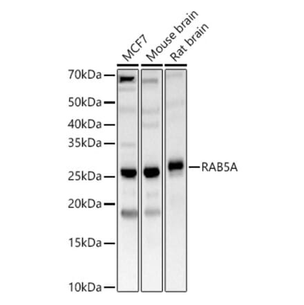 Western Blot - Anti-Rab5A Antibody (A13356) - Antibodies.com