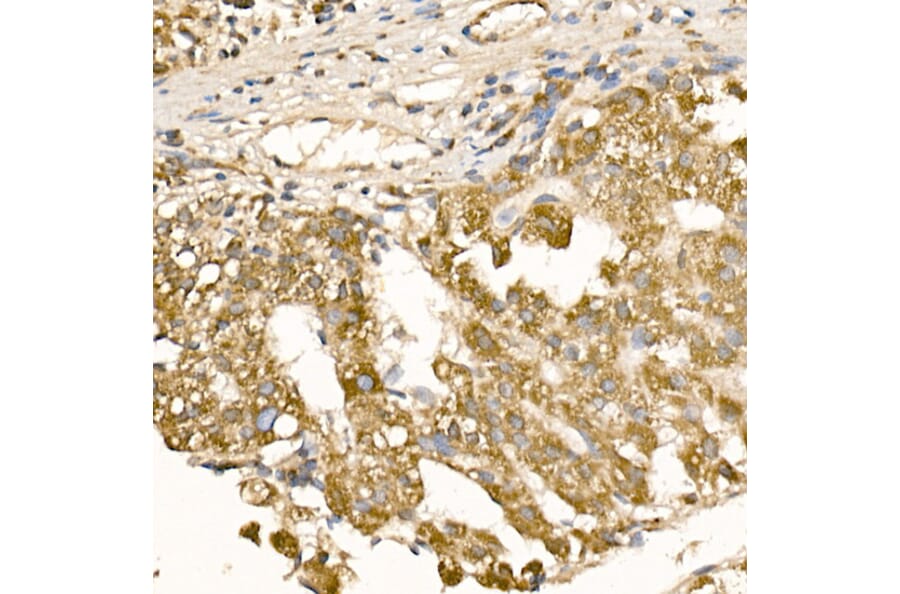 Immunohistochemistry - Anti-Rab5A Antibody (A13356) - Antibodies.com