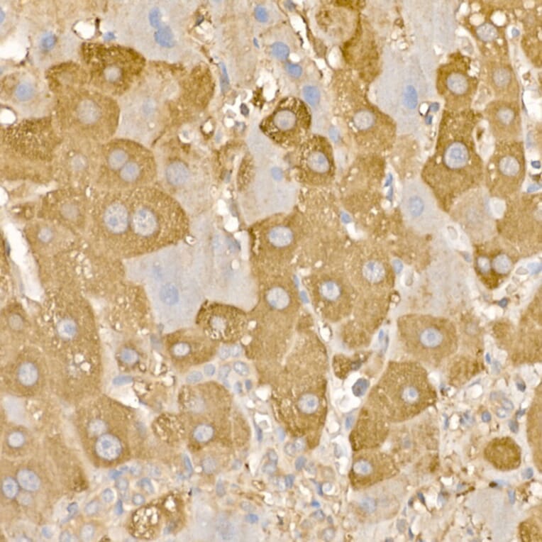 Immunohistochemistry - Anti-Rab5A Antibody (A13356) - Antibodies.com
