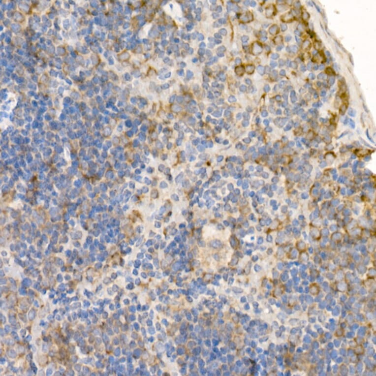 Immunohistochemistry - Anti-Rab5A Antibody (A13356) - Antibodies.com