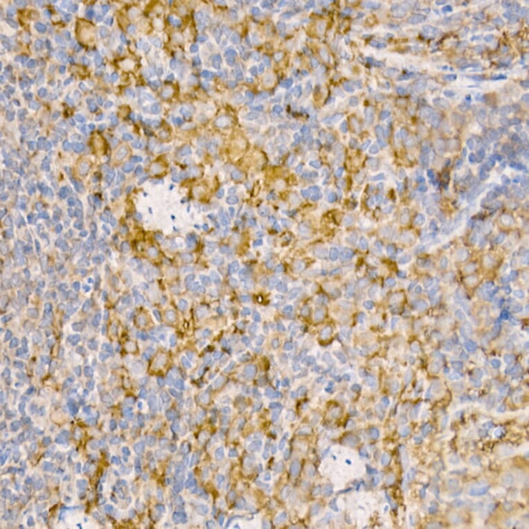 Immunohistochemistry - Anti-Rab5A Antibody (A13356) - Antibodies.com