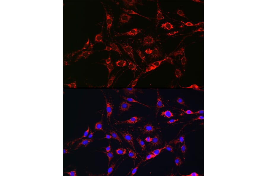 Immunofluorescence - Anti-Rab5A Antibody (A13356) - Antibodies.com