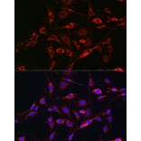 Immunofluorescence - Anti-Rab5A Antibody (A13356) - Antibodies.com