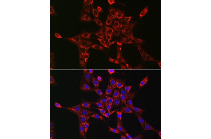 Immunofluorescence - Anti-Rab5A Antibody (A13356) - Antibodies.com