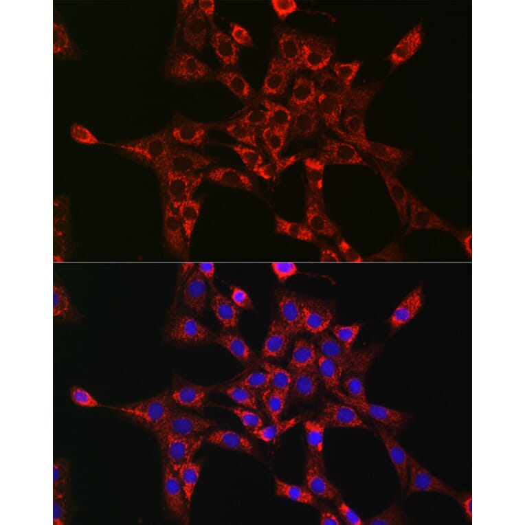 Immunofluorescence - Anti-Rab5A Antibody (A13356) - Antibodies.com