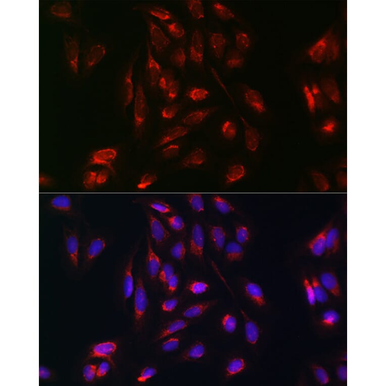 Immunofluorescence - Anti-Rab5A Antibody (A13356) - Antibodies.com