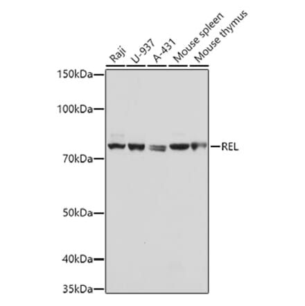 Western Blot - Anti-c-Rel Antibody (A13357) - Antibodies.com