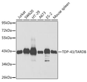 Western Blot - Anti-TDP43 Antibody (A13358) - Antibodies.com