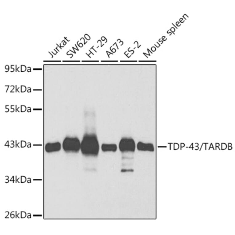 Western Blot - Anti-TDP43 Antibody (A13358) - Antibodies.com