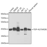 Western Blot - Anti-TDP43 Antibody (A13358) - Antibodies.com