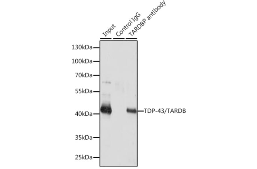 Western Blot - Anti-TDP43 Antibody (A13358) - Antibodies.com