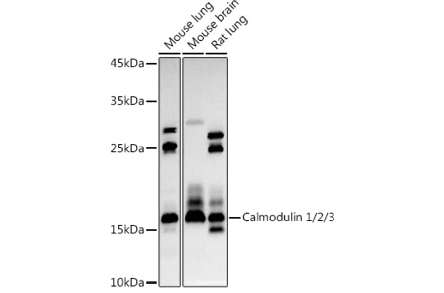 Western Blot - Anti-Calmodulin 1 + Calmodulin 2 + Calmodulin 3 Antibody (A13359) - Antibodies.com