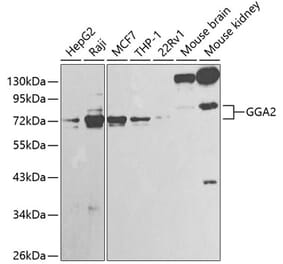 Western Blot - Anti-GGA2 Antibody (A13360) - Antibodies.com