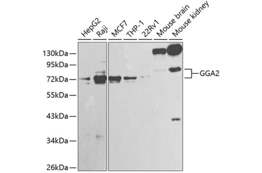 Western Blot - Anti-GGA2 Antibody (A13360) - Antibodies.com