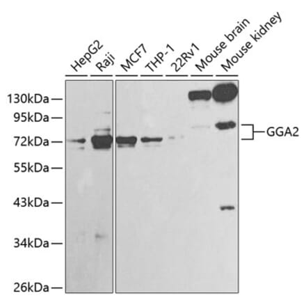 Western Blot - Anti-GGA2 Antibody (A13360) - Antibodies.com