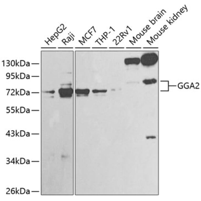 Western Blot - Anti-GGA2 Antibody (A13360) - Antibodies.com