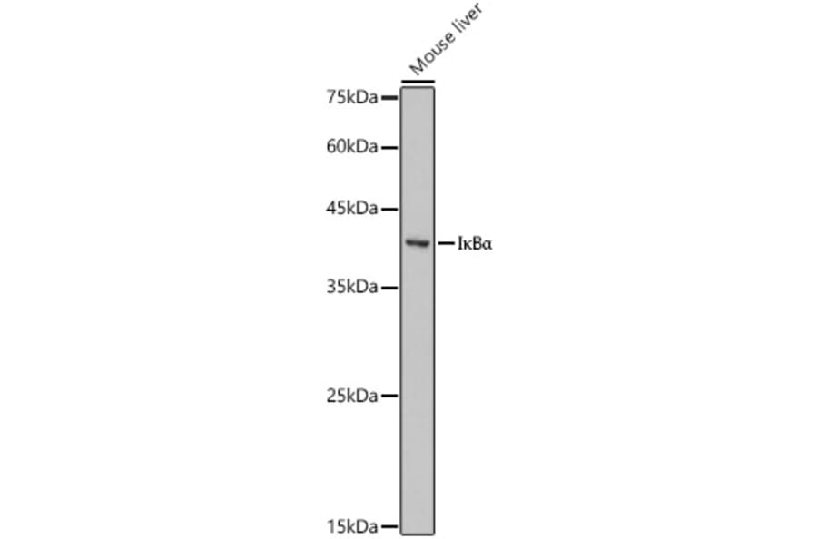 Western Blot - Anti-IkB alpha Antibody (A13361) - Antibodies.com