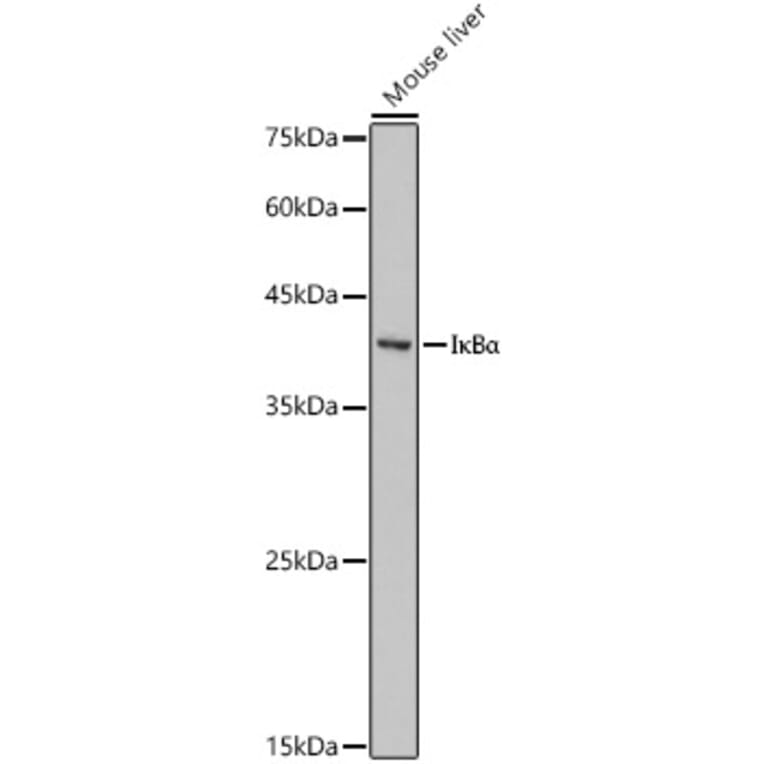 Western Blot - Anti-IkB alpha Antibody (A13361) - Antibodies.com