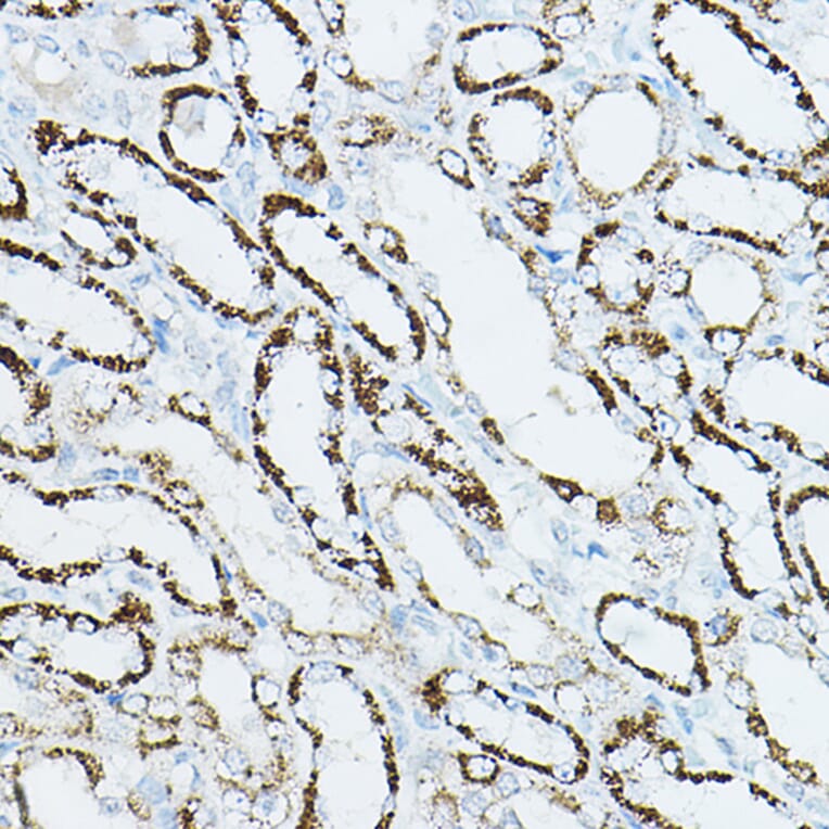 Immunohistochemistry - Anti-CDC42 Antibody (A13362) - Antibodies.com