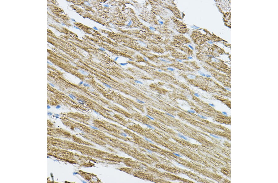 Immunohistochemistry - Anti-CDC42 Antibody (A13362) - Antibodies.com