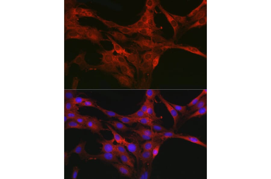 Immunofluorescence - Anti-CDC42 Antibody (A13362) - Antibodies.com