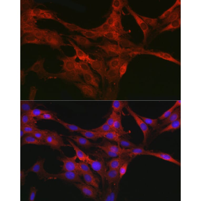 Immunofluorescence - Anti-CDC42 Antibody (A13362) - Antibodies.com