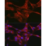 Immunofluorescence - Anti-CDC42 Antibody (A13362) - Antibodies.com
