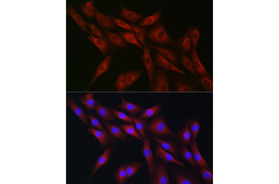 Immunofluorescence - Anti-CDC42 Antibody (A13362) - Antibodies.com