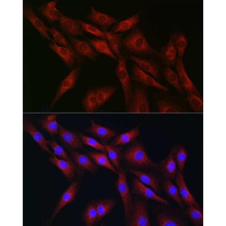 Immunofluorescence - Anti-CDC42 Antibody (A13362) - Antibodies.com