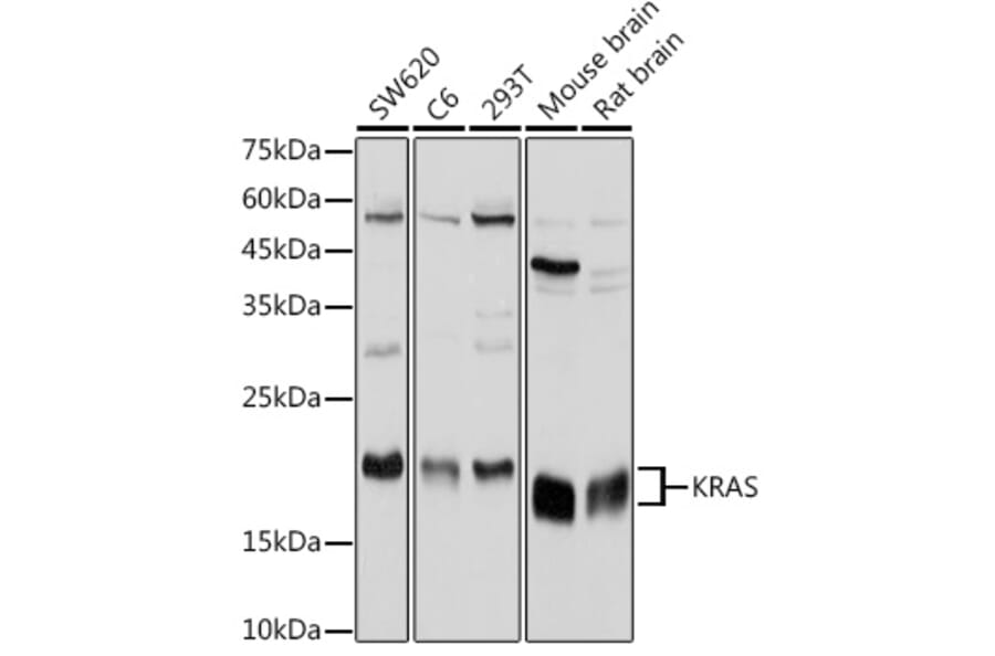 Western Blot - Anti-KRAS Antibody (A13364) - Antibodies.com
