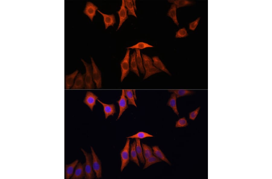 Immunofluorescence - Anti-KRAS Antibody (A13364) - Antibodies.com