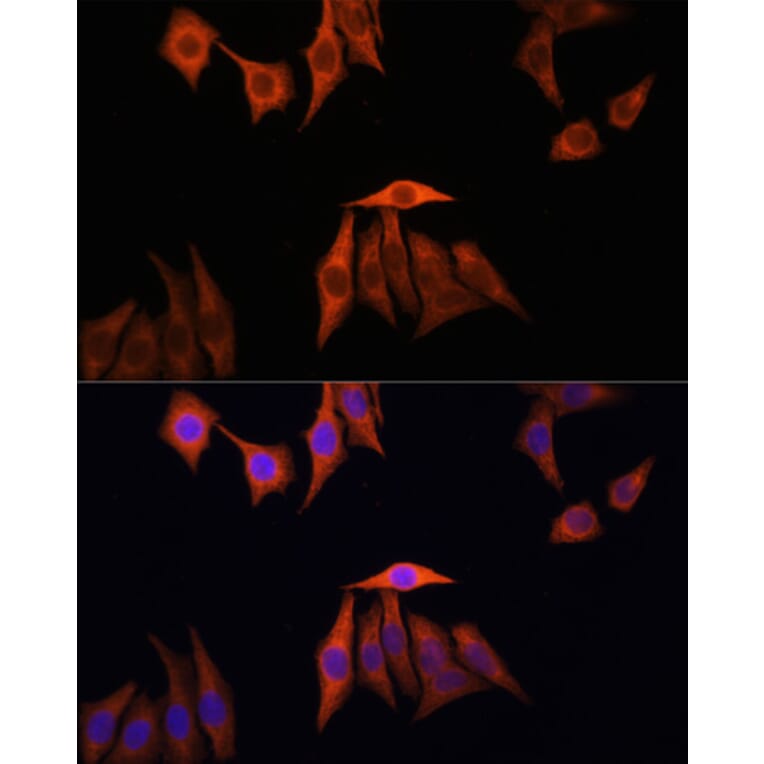 Immunofluorescence - Anti-KRAS Antibody (A13364) - Antibodies.com