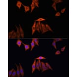 Immunofluorescence - Anti-KRAS Antibody (A13364) - Antibodies.com