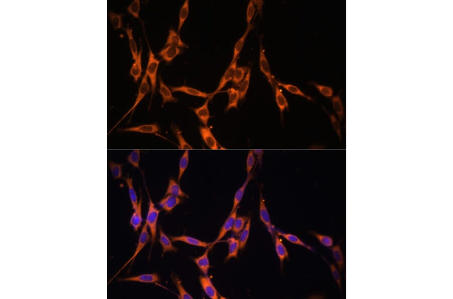 Immunofluorescence - Anti-KRAS Antibody (A13364) - Antibodies.com