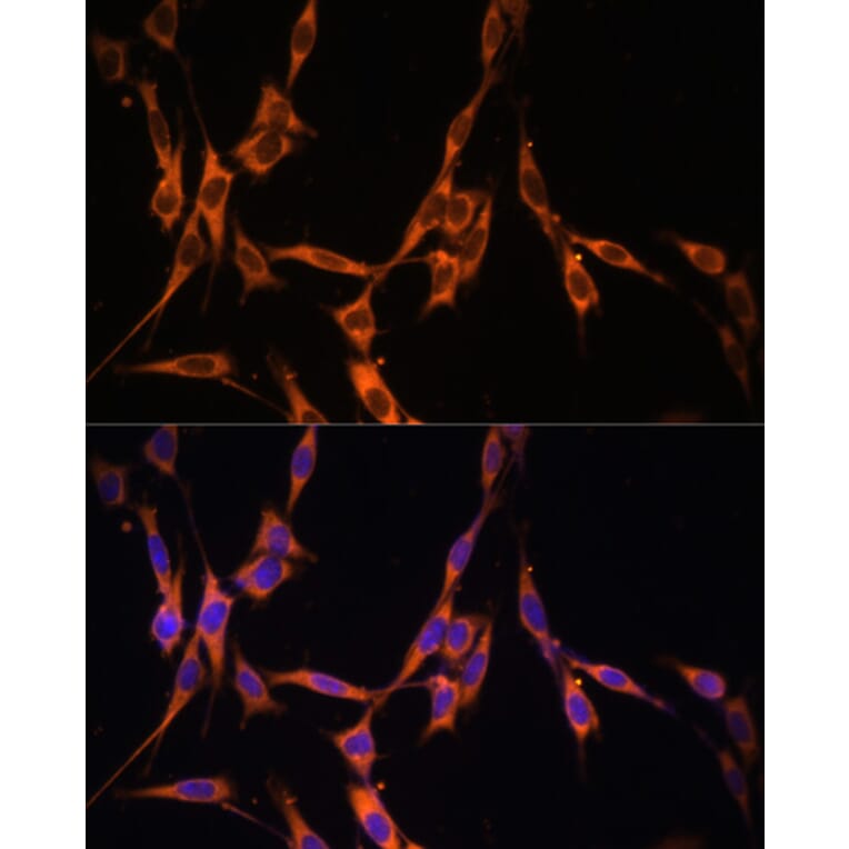 Immunofluorescence - Anti-KRAS Antibody (A13364) - Antibodies.com