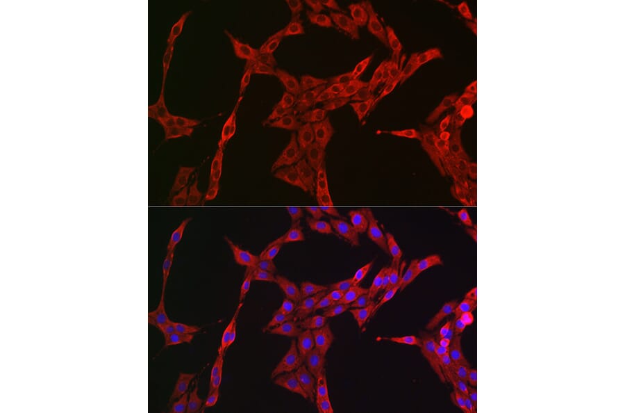 Immunofluorescence - Anti-STAT3 Antibody (A13365) - Antibodies.com