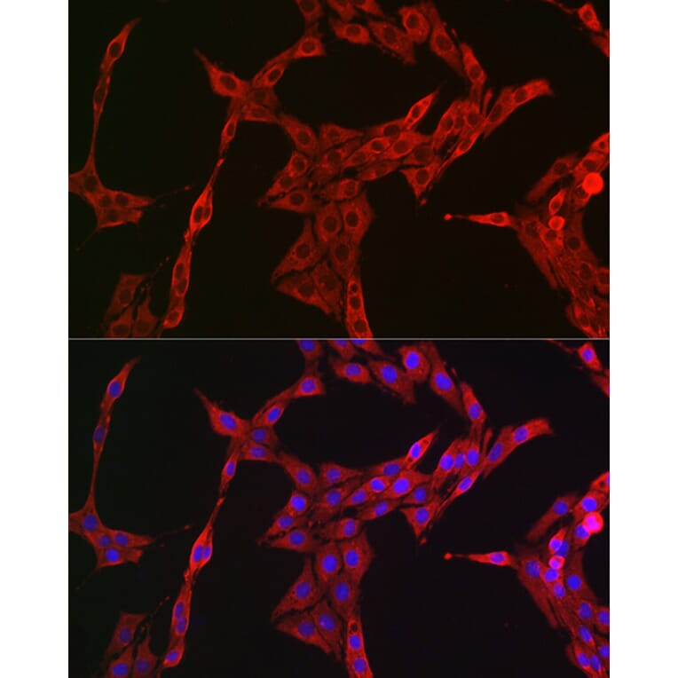 Immunofluorescence - Anti-STAT3 Antibody (A13365) - Antibodies.com