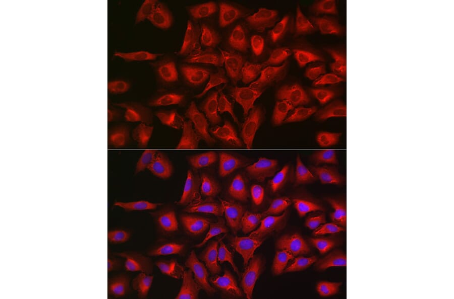 Immunofluorescence - Anti-STAT3 Antibody (A13365) - Antibodies.com