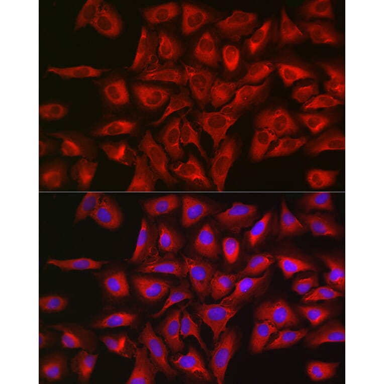 Immunofluorescence - Anti-STAT3 Antibody (A13365) - Antibodies.com