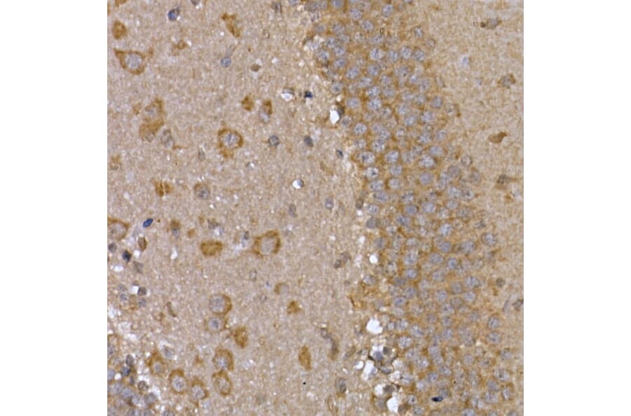 Immunohistochemistry - Anti-STAT3 Antibody (A13365) - Antibodies.com