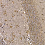 Immunohistochemistry - Anti-STAT3 Antibody (A13365) - Antibodies.com