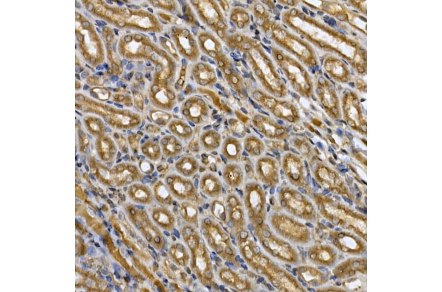Immunohistochemistry - Anti-STAT3 Antibody (A13365) - Antibodies.com