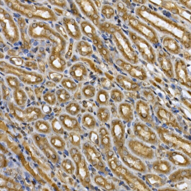 Immunohistochemistry - Anti-STAT3 Antibody (A13365) - Antibodies.com