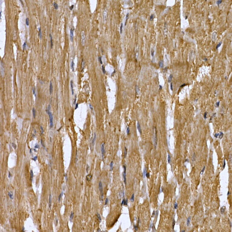 Immunohistochemistry - Anti-STAT3 Antibody (A13365) - Antibodies.com