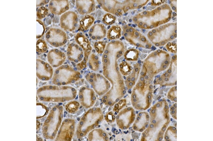 Immunohistochemistry - Anti-STAT3 Antibody (A13365) - Antibodies.com