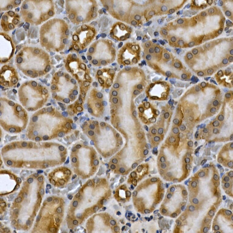 Immunohistochemistry - Anti-STAT3 Antibody (A13365) - Antibodies.com