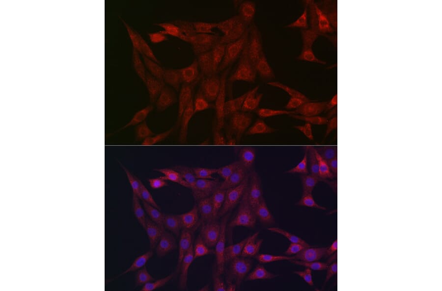 Immunofluorescence - Anti-STAT3 Antibody (A13365) - Antibodies.com