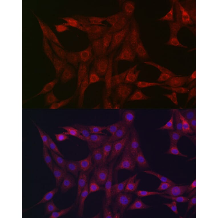 Immunofluorescence - Anti-STAT3 Antibody (A13365) - Antibodies.com